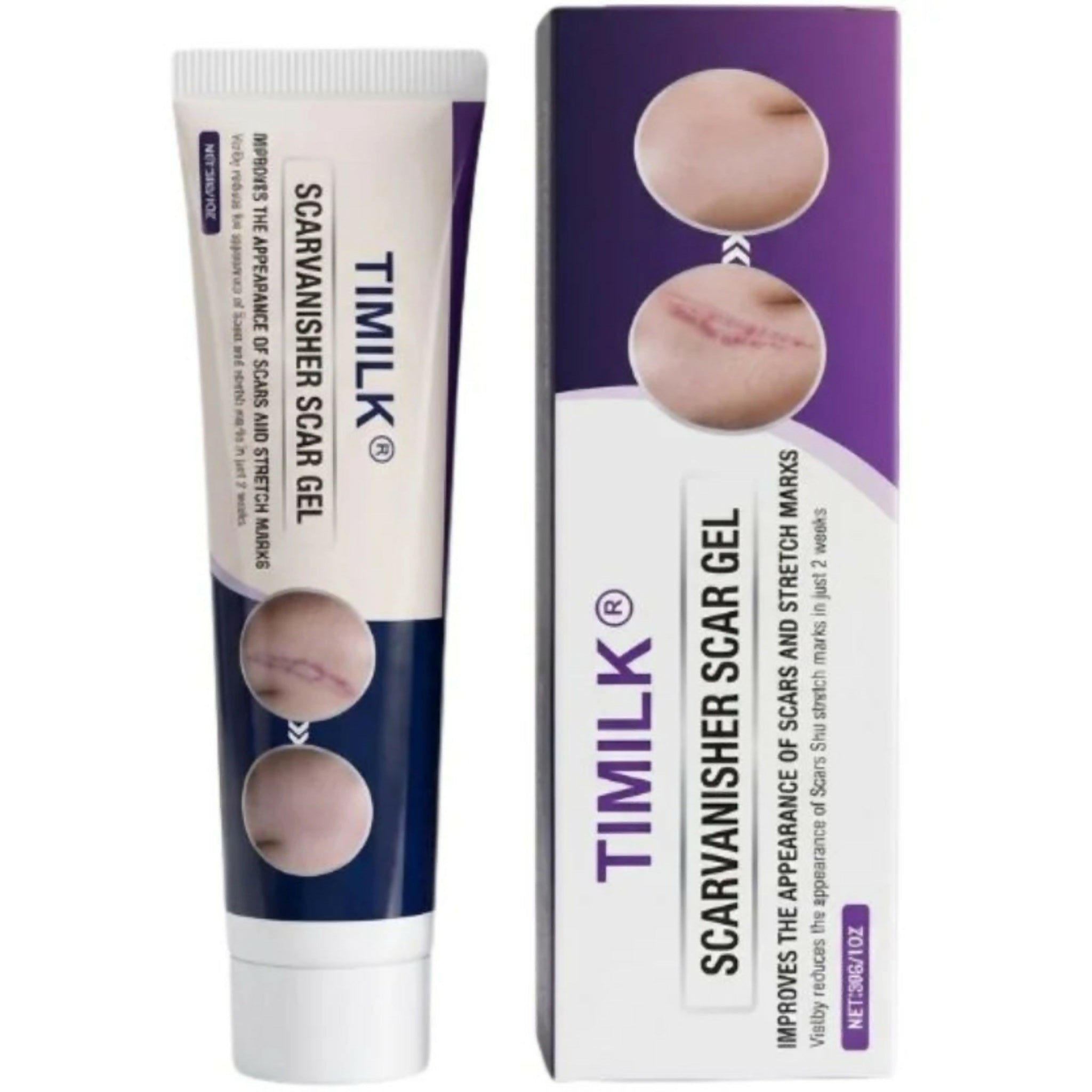 IMILK Scarvanisher Scar Gel 30g | Advanced Scar & Stretch Marks Removal Cream | Fast-Absorbing Skin Repair Gel