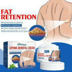 50g Herbal Lipoma Removal Cream – Skin Care Cream for Lipoma-Prone Areas
