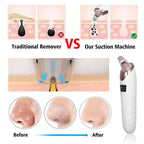 Face Vacuum Suction Blackhead Remover Pore Cleaner