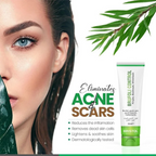 Brufoli Control Cream, Effective Acne Treatment, for Clearer, Healthier Skin