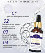 Aichun Beauty Anti - Acne Whitening Facial Serum Aloe Vera Extract Salicylic Acid Repairs Damaged Skin | 30ml