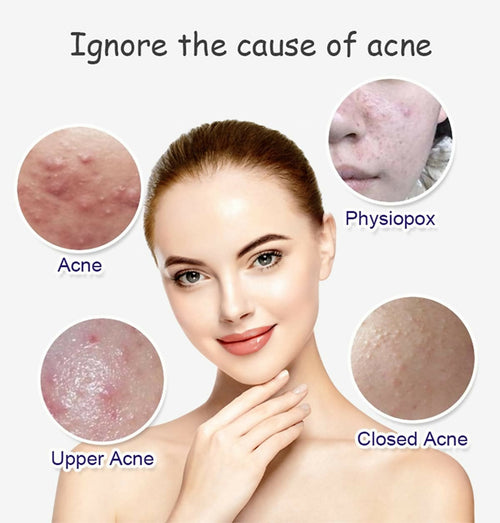 Aichun Beauty Anti - Acne Whitening Facial Serum Aloe Vera Extract Salicylic Acid Repairs Damaged Skin | 30ml