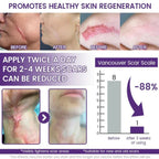 TIMILK Scarvanisher Scar Gel 30g | Advanced Scar & Stretch Marks Removal Cream | Fast-Absorbing Skin Repair Gel