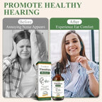 Yuaben Tinnitus Relief Drops | Healthy Hearing Support System | Ear Care Drops for Ringing, Buzzing & Ear Wellness | 60mlYuaben Tinnitus Relief Drops | Healthy Hearing Support System | Ear Care Drops for Ringing, Buzzing & Ear Wellness | 60ml