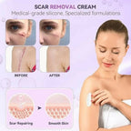 IMILK Scarvanisher Scar Gel 30g | Advanced Scar & Stretch Marks Removal Cream | Fast-Absorbing Skin Repair Gel
