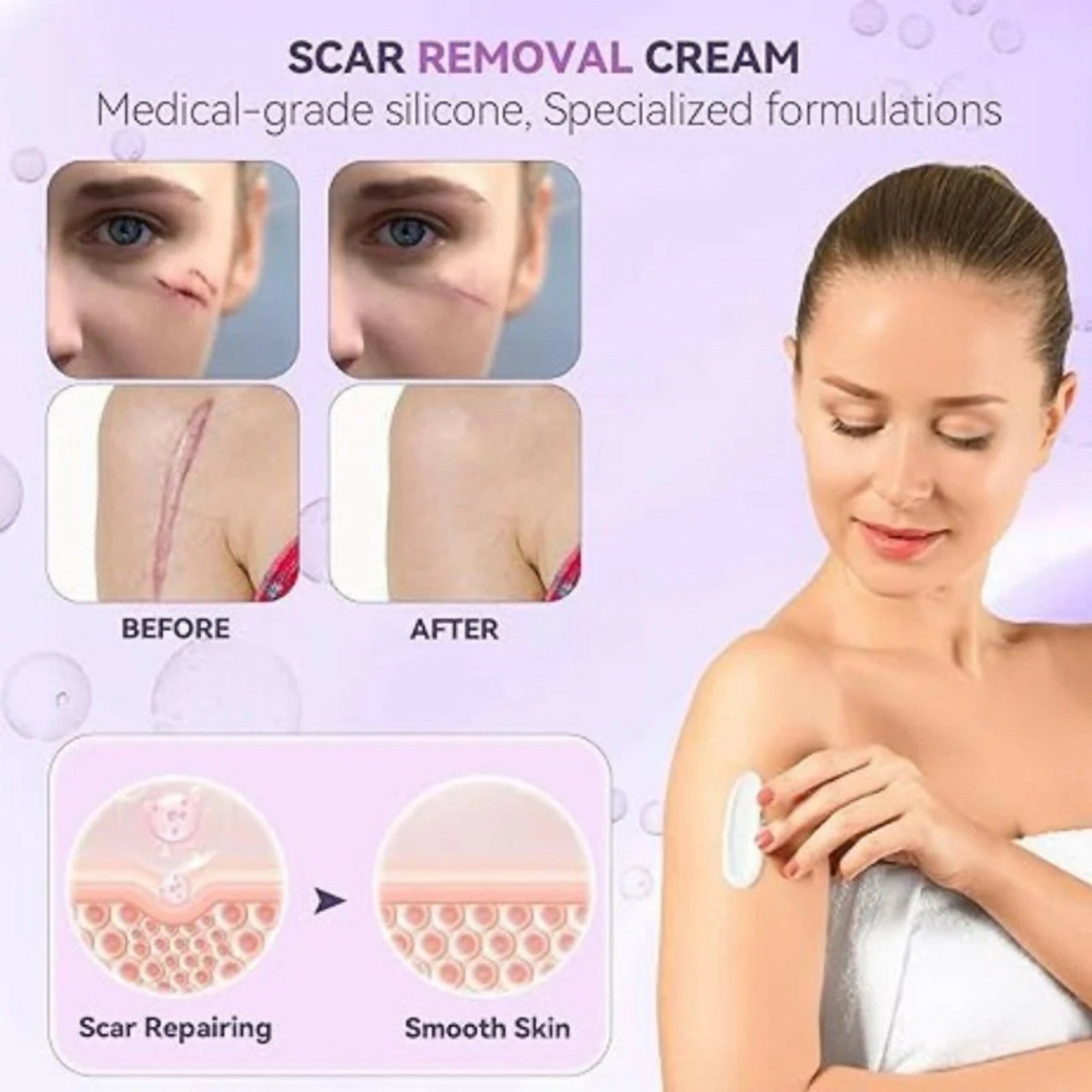IMILK Scarvanisher Scar Gel 30g | Advanced Scar & Stretch Marks Removal Cream | Fast-Absorbing Skin Repair Gel