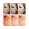 Cream, Radiant Skin & Whitening, for Dark Spots & Melasma