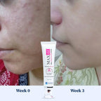 Cream, Maxdif Brightening Transformative Keeping Skin Supple & Moisturized