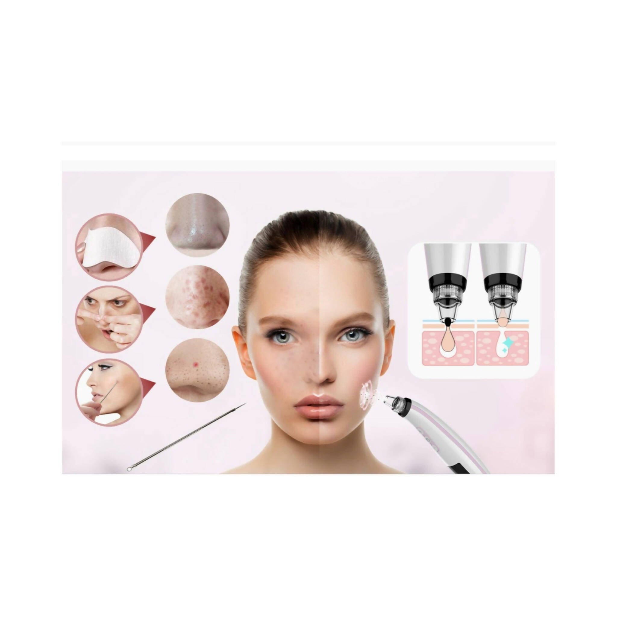 Blackhead Remover: Electric Vacuum Kit, 5 Suction Power Levels, 5 Probes
