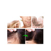 Wellice Onion Hair Fall Oil, Hair Care & Treatment Oil 30ml, for Unisex