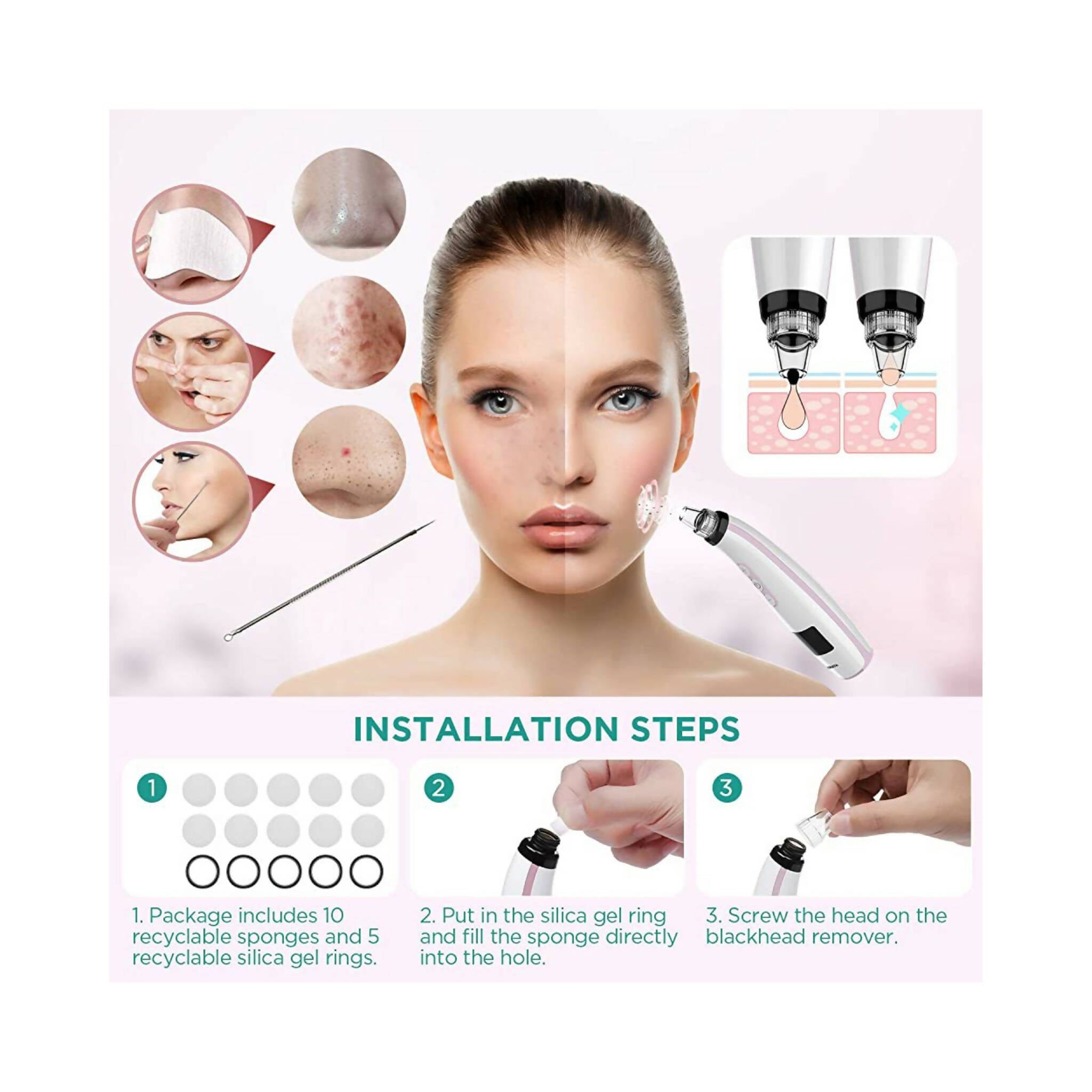 Blackhead Remover: Electric Vacuum Kit, 5 Suction Power Levels, 5 Probes